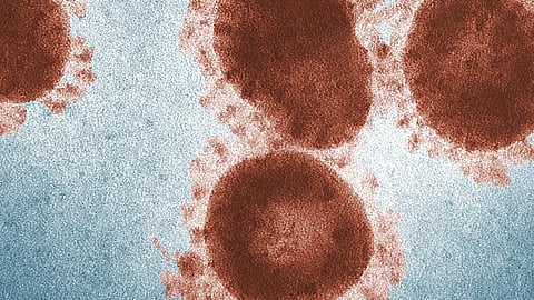 microscopic view of red microbes on a blue background