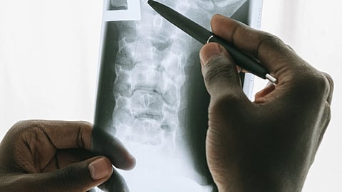 health personnel holding a pen on a spinal coed x-ray