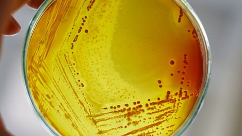 person holding a petri dish