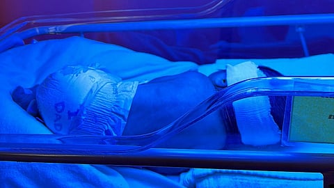 A newborn baby receiving phototherapy treatment in an incubator under blue light