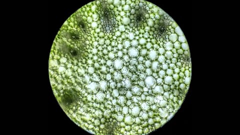 microscopic view of algae specimen