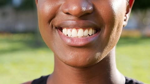 A person with a wide smile displaying his teeth