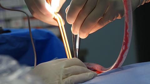2 surgeons working on a surgery and holding medical equipment. 