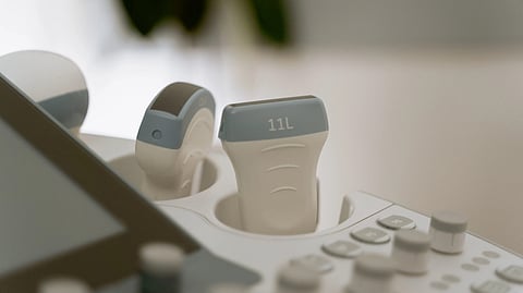 ultrasound probe