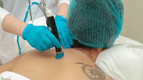 Back view of a professional using laser equipment on patient