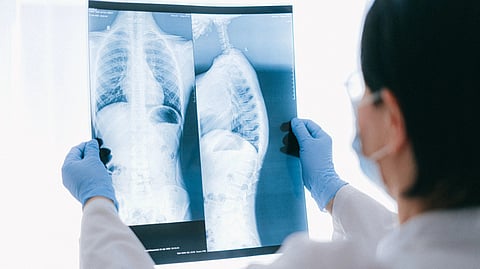doctor holding an x- ray result