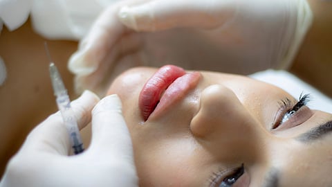 A person holding a filler injection and using it on a woman's lips.