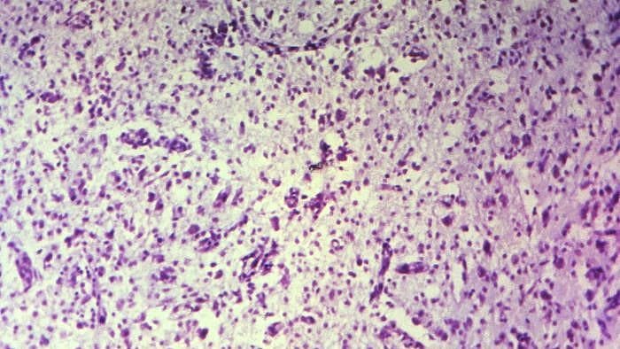 Cedars-Sinai Creates Computer Models of Brain Cells