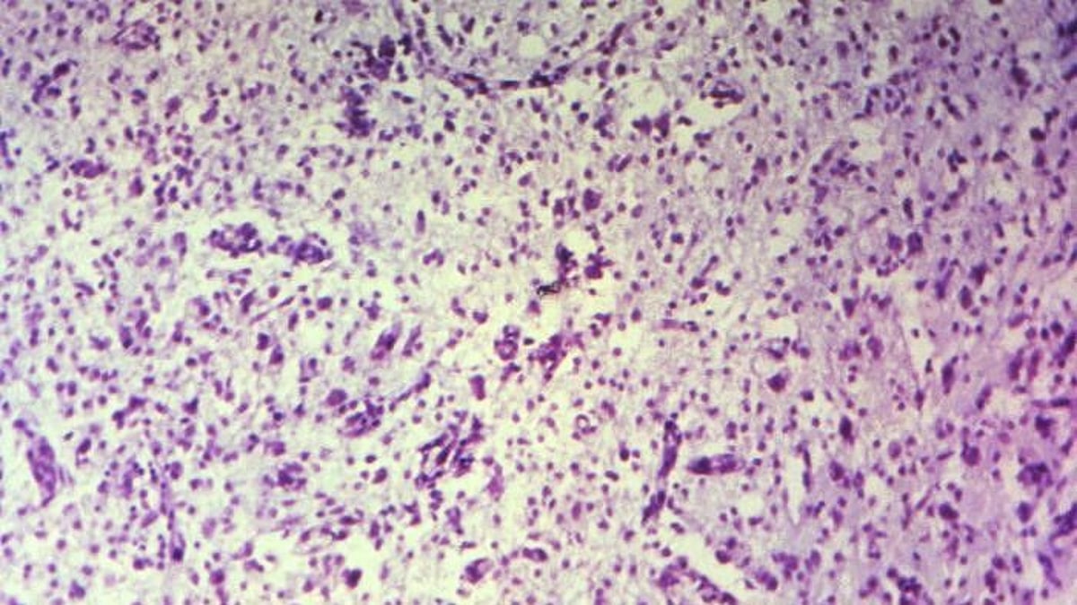 Cedars-Sinai Creates Computer Models of Brain Cells