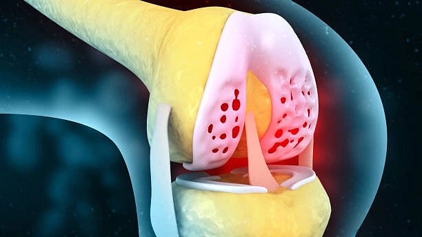 Joint-pain have many forms of pain relief but risks may persist