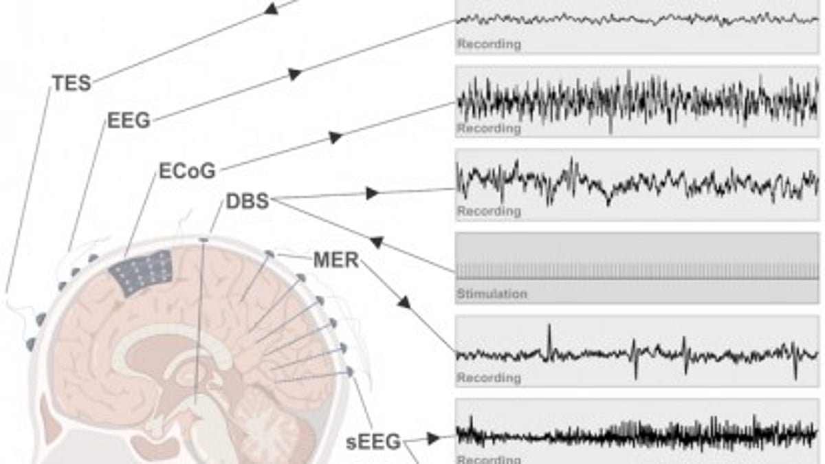 Deep brain-machine interfaces - interacting with Human deep brain