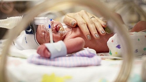 Does Piccolo PDA Closure Improve for Babies?