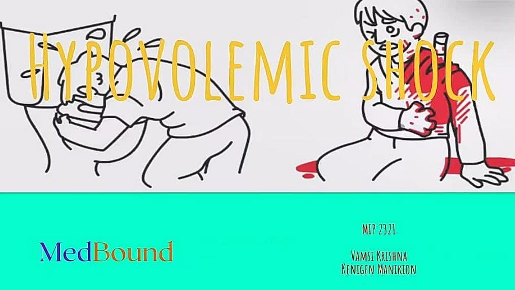 MIP Presentation on Hypovolemic Shock.