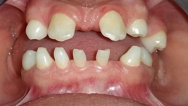 Teeth regrowth every dentists dream