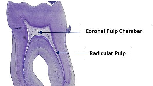 What Are Common Conditions and Disorders That Affect Tooth Pulp?
