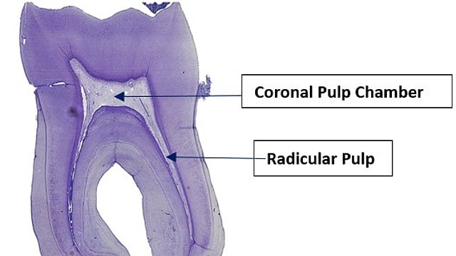 Tooth Pulp Bleeding What Are Common Conditions and Disorders That Affect Tooth Pulp?