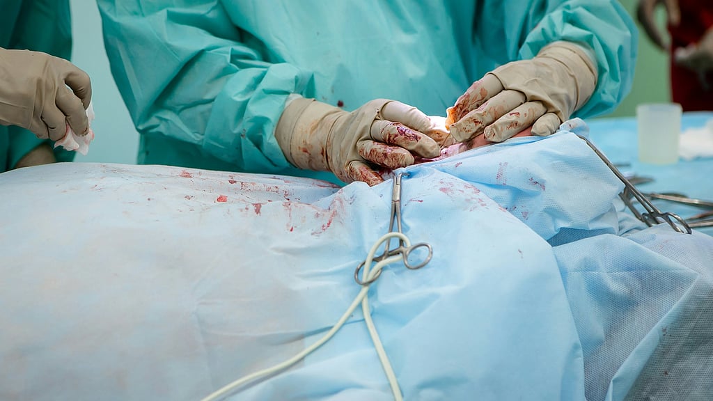 Bengal Man Gets Appendix Removed Instead of Hernia Surgery