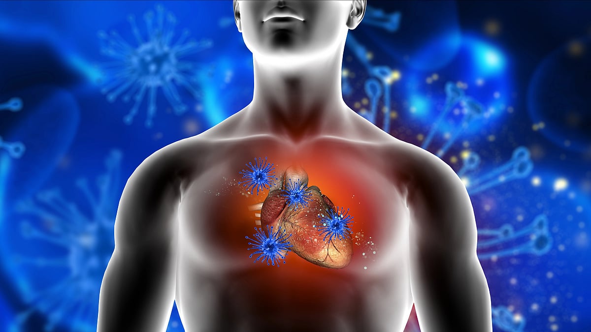 UC San Diego Research Rethinks How Heart Attacks Occur