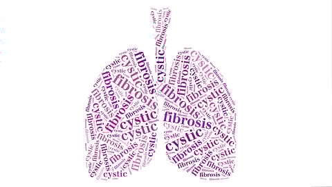 দেশে প্রথমবারের মতো পালিত হলো ‘বিশ্ব সিস্টিক ফাইব্রোসিস দিবস