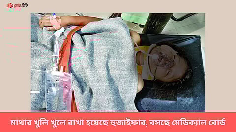 মাথার খুলি খুলে রাখা হয়েছে হুজাইফার, বসছে মেডিক্যাল বোর্ড