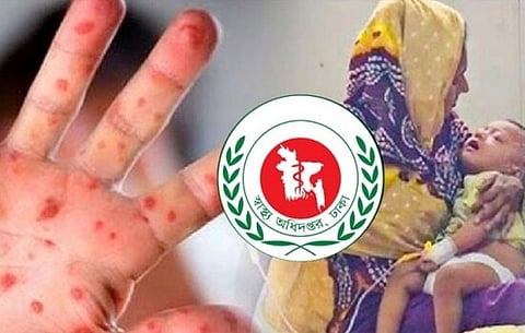 ২৪ ঘণ্টায় হাম ও হামের উপসর্গে ৩ জনের মৃত্যু