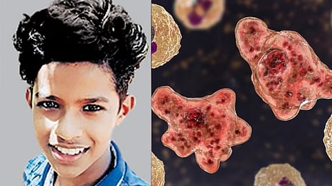 മൂക്കിലൂടെ തലച്ചോറിലേക്ക്; 'ബ്രെയിൻ ഈറ്റിങ് അമീബ' ബാധിച്ച് 15 കാരൻ മരിച്ചു