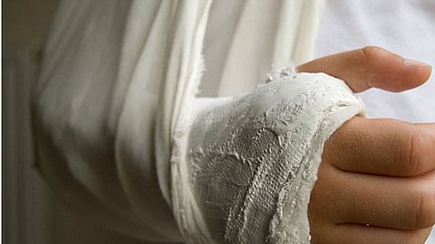 Representative image