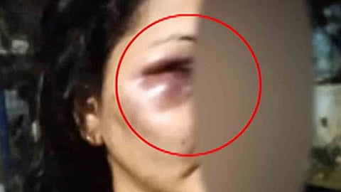 സാമ്പത്തിക തർക്കത്തെ തുടർന്ന് ജീവനക്കാരിയെ പൂട്ടിയിട്ട് മർദിച്ചു; കടയുടമ അറസ്റ്റിൽ