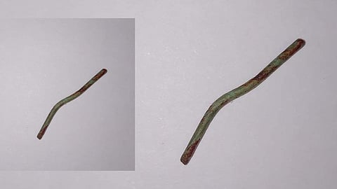 kid swallowed iron piece with cream cake