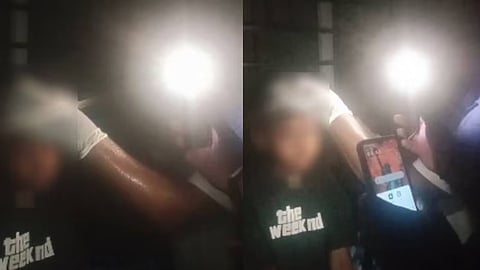 the child was taken to the hospital with a head injury;  Stitched in the light of the phone