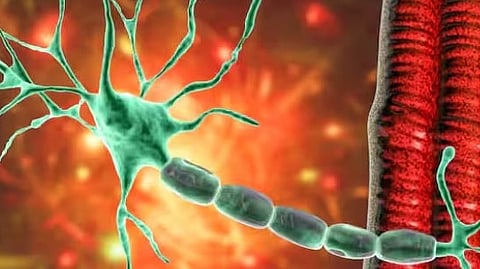 Guillain-Barré syndrome virus