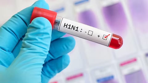 H1N1 Aluva UC College