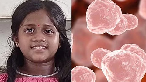 Anaya's brother, who died of amoebic encephalitis, shows symptoms