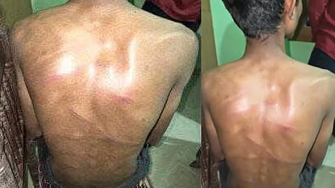 teenager was brutally beaten by his girlfriens father 