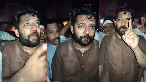 Action is needed in police atrocities against Shafi; Congress files complaint with DGP