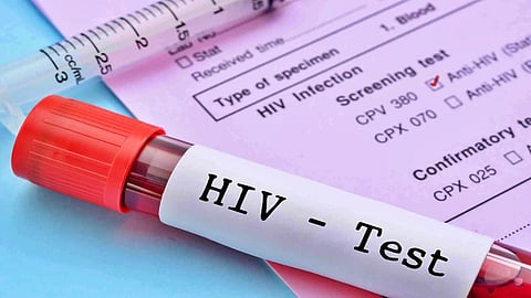 five suspended in jharkhand following children with thalasemia test hiv positive 