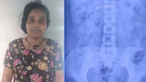 Nilambur native arrested for stealing child's gold necklace and swallowing it