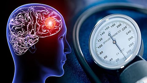 High blood pressure can affect memory