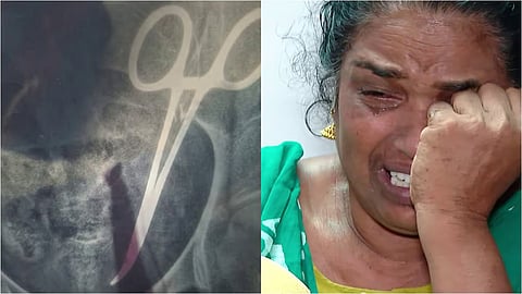 Usha Joseph, a native of Punnapra, who had been suffering from pain due to scissors in her stomach for five years, has an X-ray showing scissors on her right side.