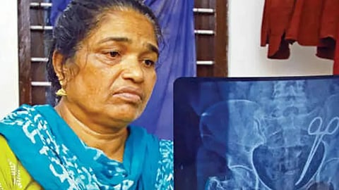 Scissors were taken out of Usha's stomach