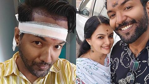 aravind krishnan about hair fix