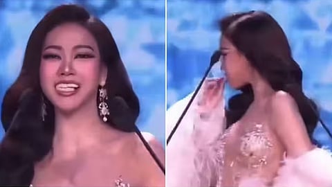 Beauty pageant contestant's teeth fall out on stage