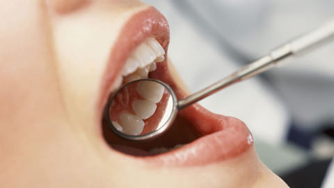 loosing teeth oral health
