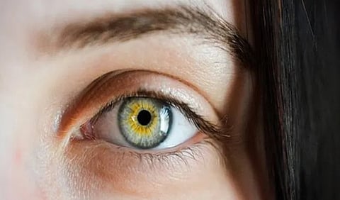 Eye- Corneal transplantation