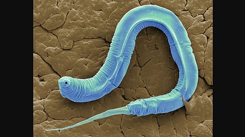 Study in worms paves way for healthy aging amidst global warming
