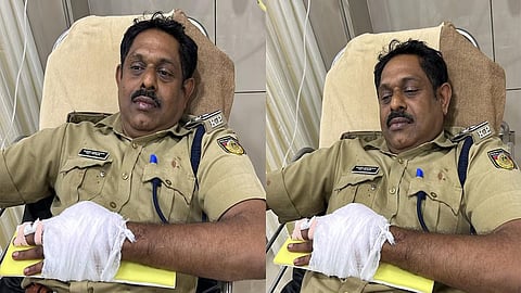 Two police officers were attacked by some people and one of them was injured