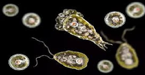 Representative image