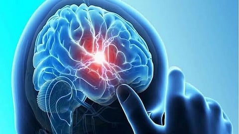 Doctors treat world's first dual case of amoebic meningitis, fungal infection 