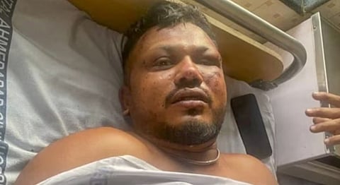 Vishwas Kumar Ramesh Air India crash survivor