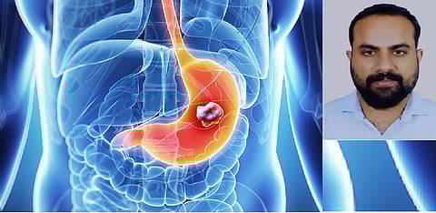  Consultant - Medical Gastroenterology, Aster Medcity, Kochi